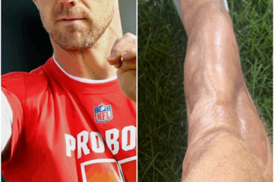 Breaking: Former Chiefs Starting QB Shares Brutal Damage Done To His Body From The NFL