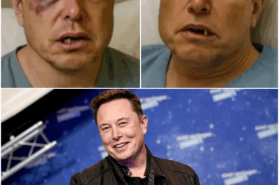 “BREAKING: Elon Musk’s Teeth Reportedly Smashed After Bizarre Fall……..